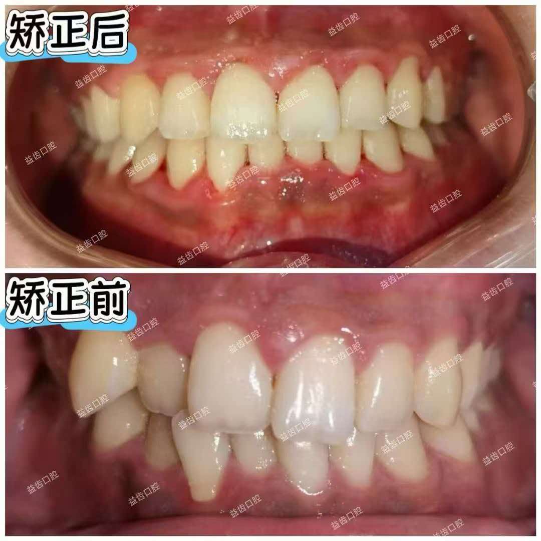 文章插图